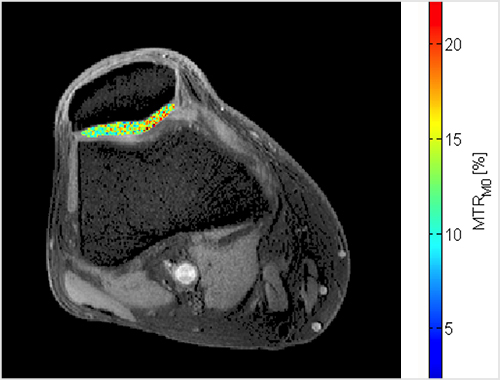 Imaging studies